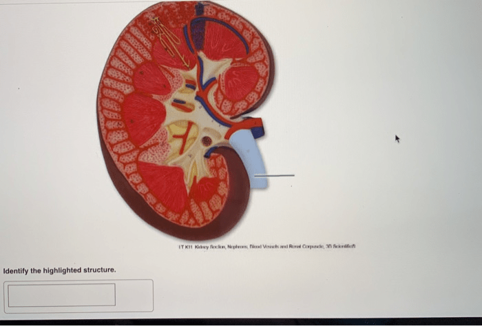 Identify the highlighted structure kidney